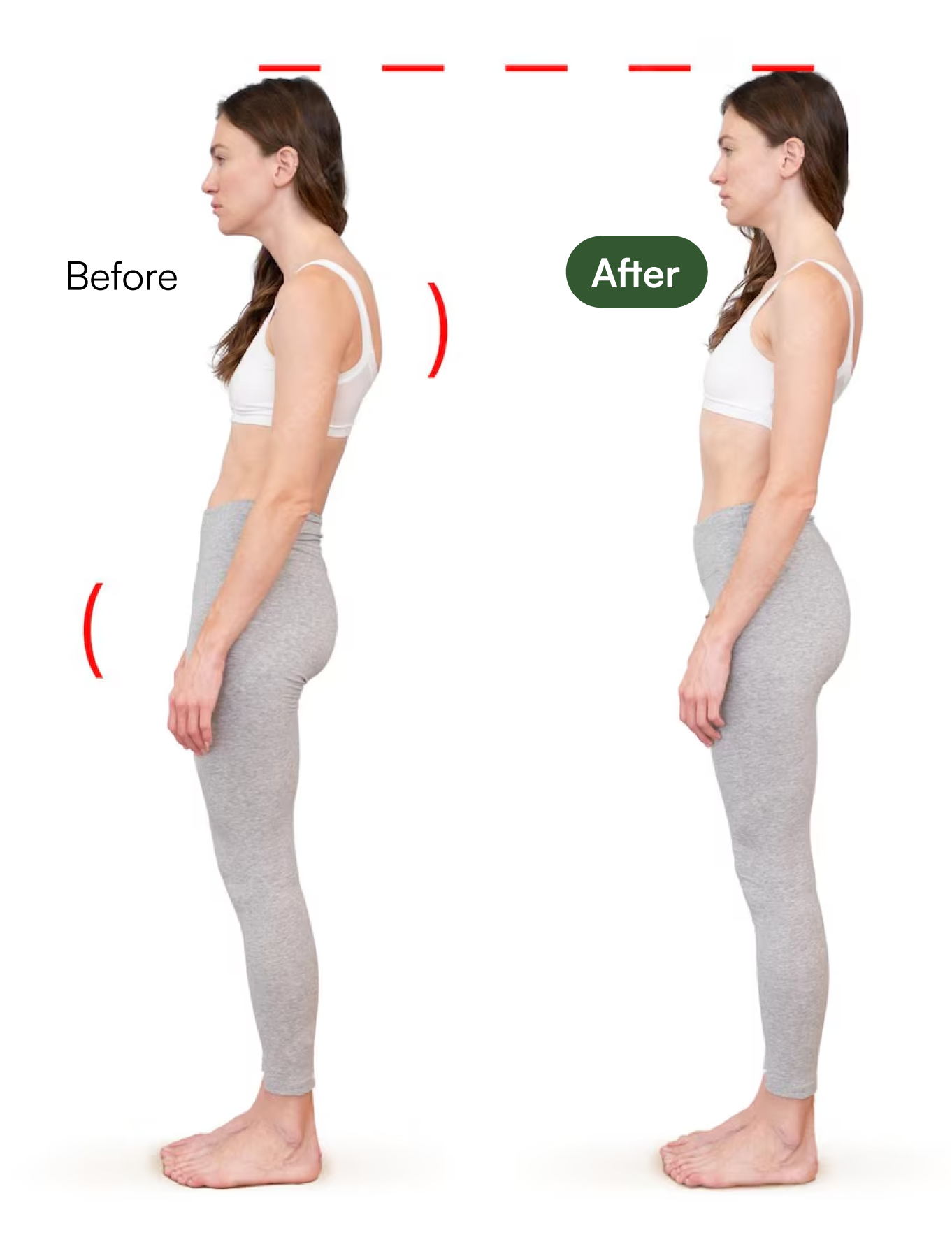 Correcting Posture Patterns
